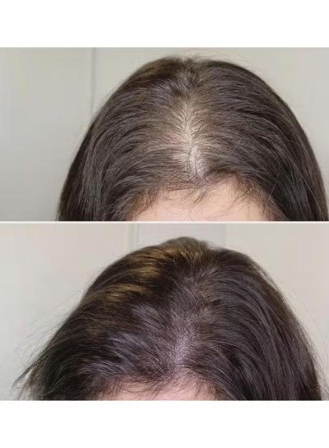 FasterFocus Faster Hair Back  Oilex Oil Four Oil 100Ml - Image 3